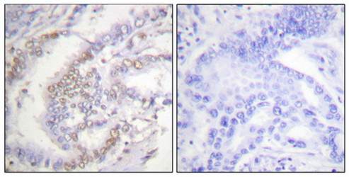 FANCD2 (Phospho-Ser222) Antibody