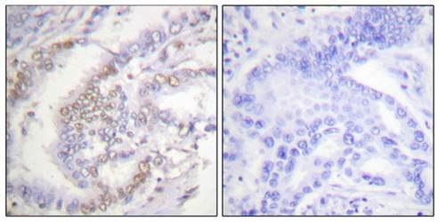 FANCD2 (phospho-Ser222) antibody