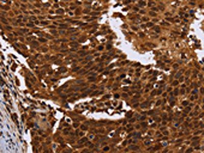 FANCF Antibody