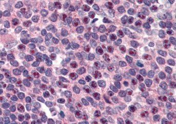 Goat anti-FANCG / XRCC9 Antibody