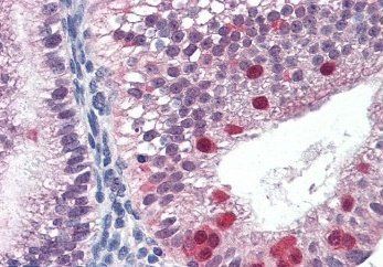 Goat anti-FANCG / XRCC9 Antibody