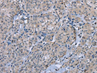 FAP Antibody