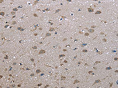 FAP Antibody