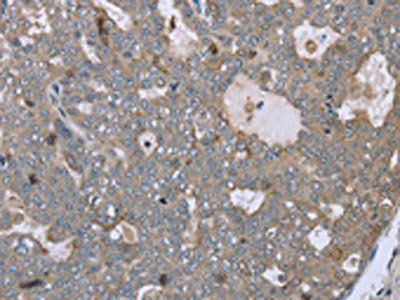 FAR2 Antibody