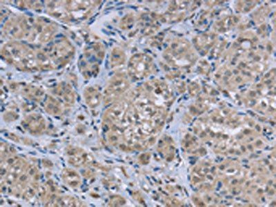 FAR2 Antibody