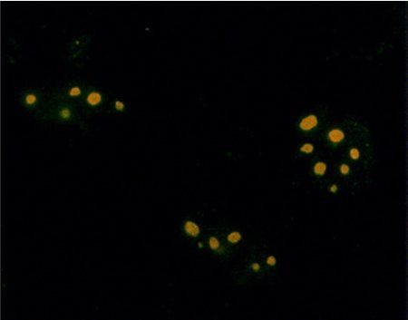 Rabbit Farnesyl Antibody