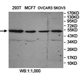 FARS2 Rabbit Polyclonal Antibody