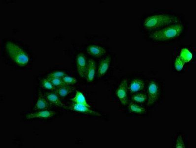 FARSB Antibody