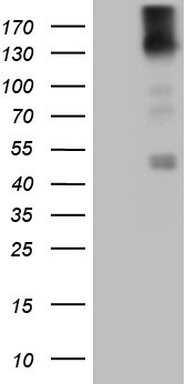 FARSB Antibody