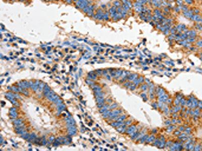 FAS Antibody