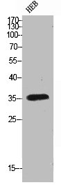 FAS Antibody