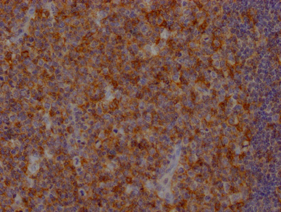 FAS Recombinant Monoclonal Antibody