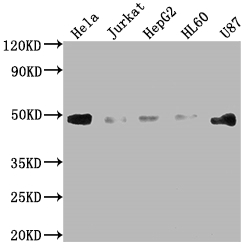 FAS Recombinant Monoclonal Antibody