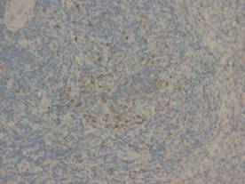 Anti-Fas Antibody
