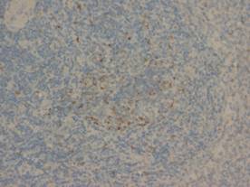 Fas Antibody