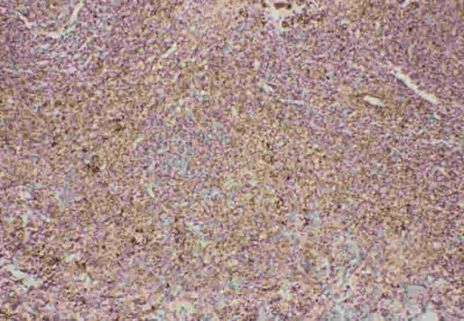 Anti-Fas Antibody