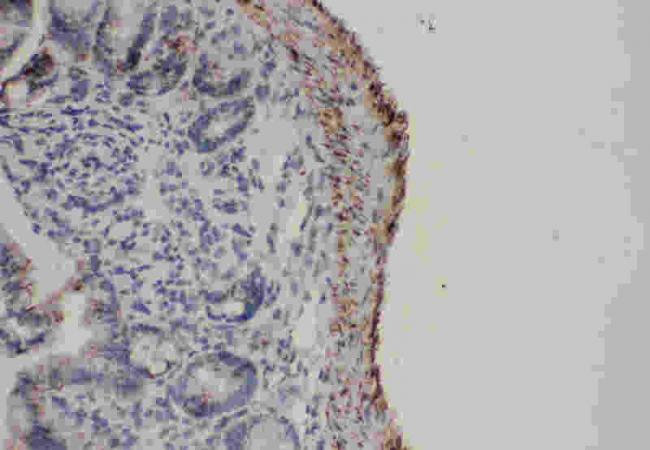 Anti-Fas Antibody