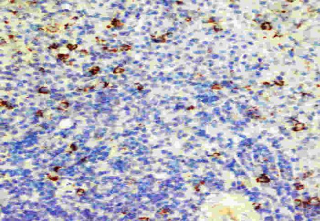 Anti-Fas Antibody