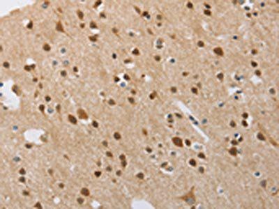 FASLG Antibody