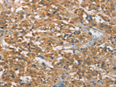 FASLG Antibody