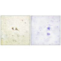 FASLG Antibody