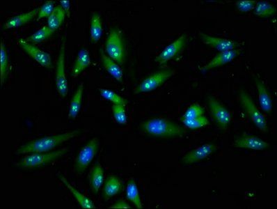 FASN Antibody