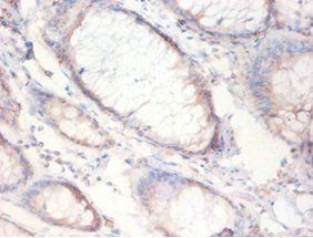 FASN Antibody