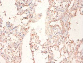 FASN Antibody