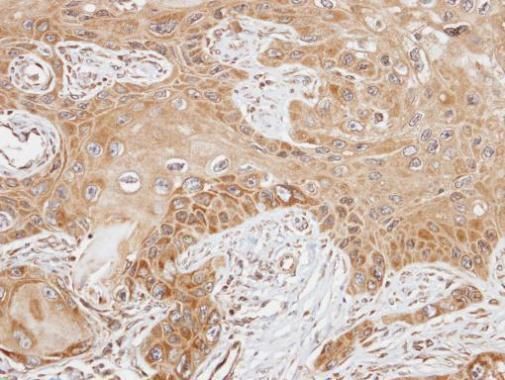 FAST antibody