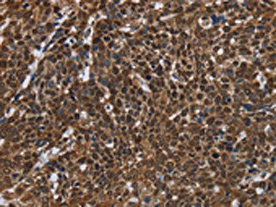 FASTKD2 Antibody