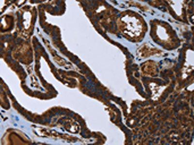 FASTKD2 antibody