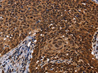 FASTKD5 Antibody