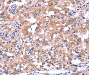 FAT1 Rabbit Polyclonal Antibody
