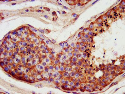 FATE1 Antibody