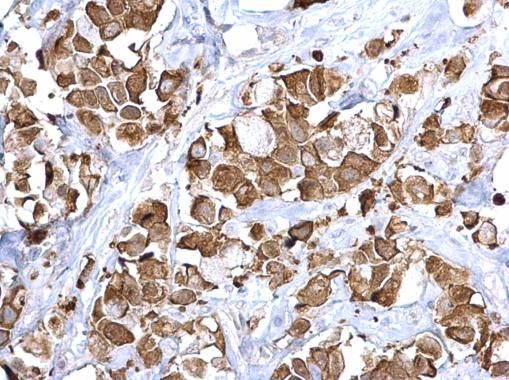 Fatty Acid Synthase antibody [N1], N-term