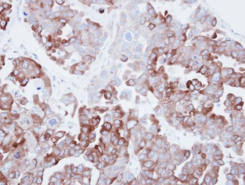 Fatty Acid Synthase antibody [N1], N-term