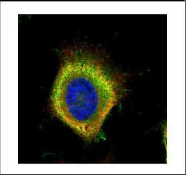 Fatty Acid Synthase antibody [N1N2], N-term