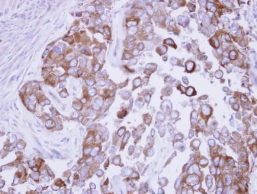 Fatty Acid Synthase antibody [N1N2], N-term