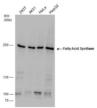 Fatty Acid Synthase antibody