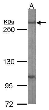 Fatty Acid Synthase antibody