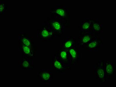 FAU Antibody