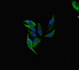 FAU antibody