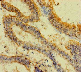 FAU Antibody