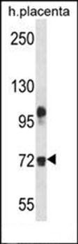 FBLN1 antibody