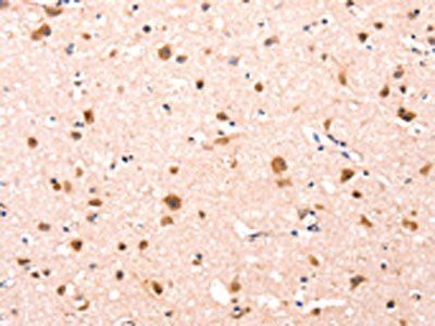 FBLN1 Antibody