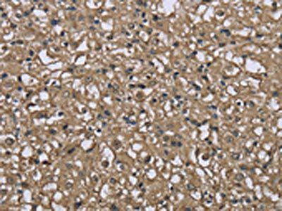 FBP1 Antibody
