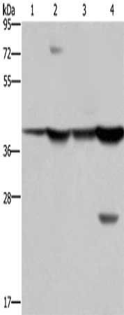 FBP1 Antibody