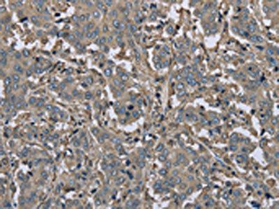 FBP1 Antibody