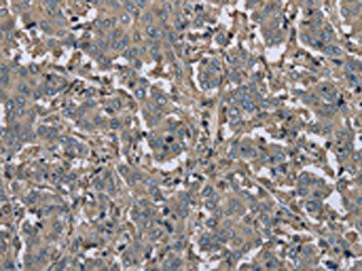 FBP1 antibody