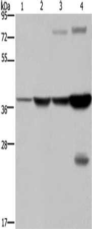 FBP1 Antibody